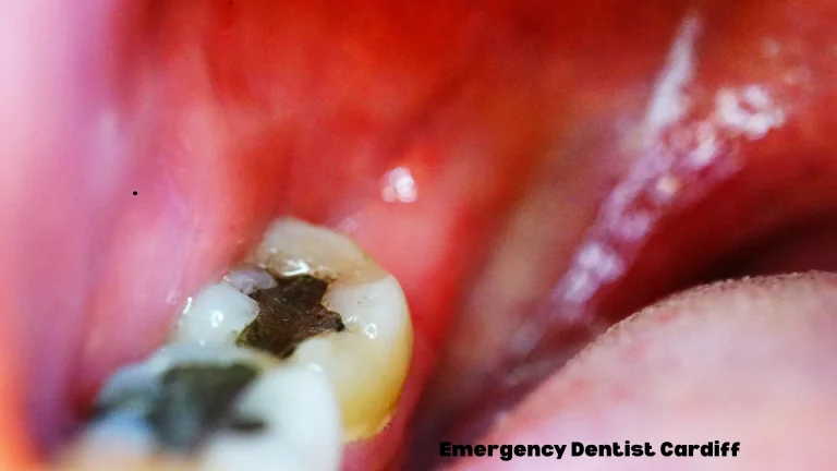 emergency dentist in cardiff