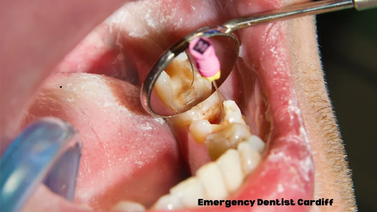 root canal therapy