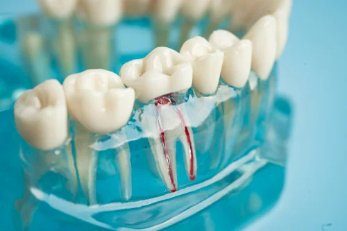 emergency dentist cardiff