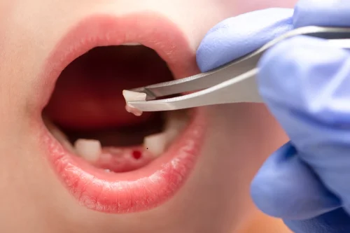 emergency dental services