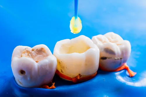 emergency dental services