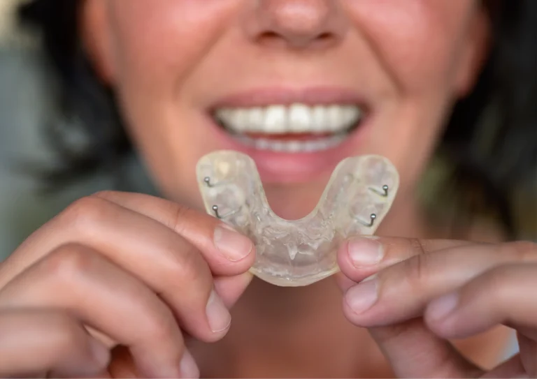 Best-Mouthguards-for-Night-Grinding