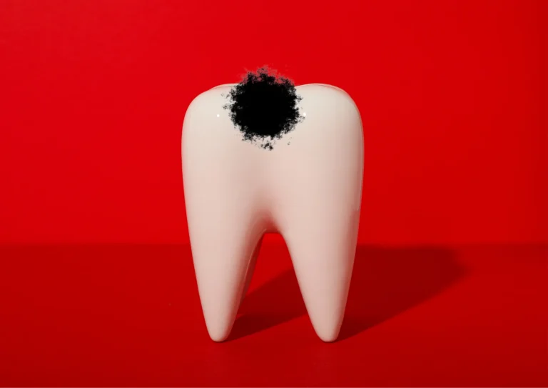 black spot on tooth