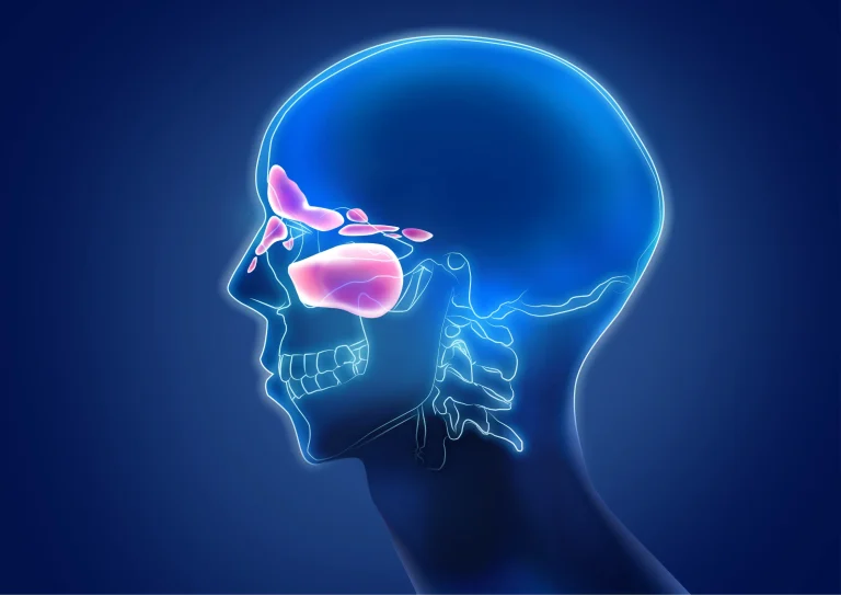 Sinus-Pressure-and-Tooth-Pain