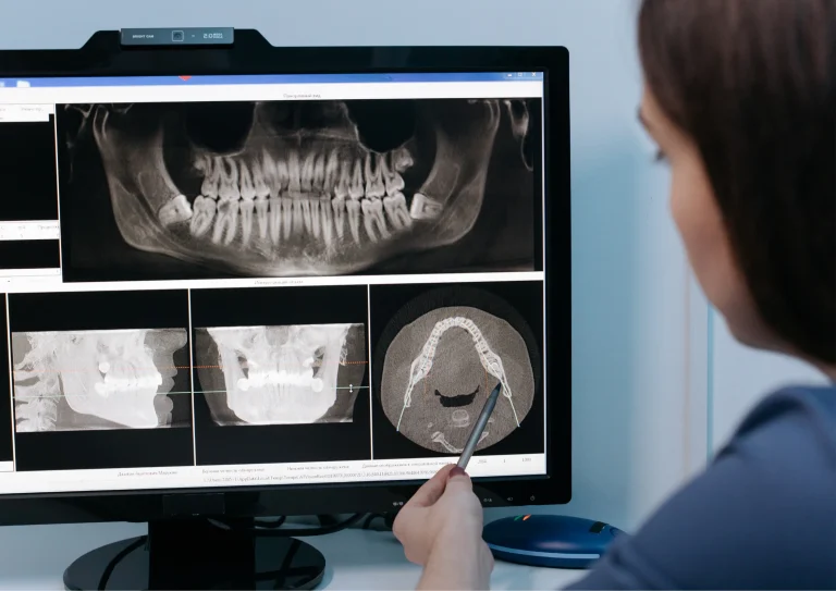 Why Dental Emergencies Are More Common